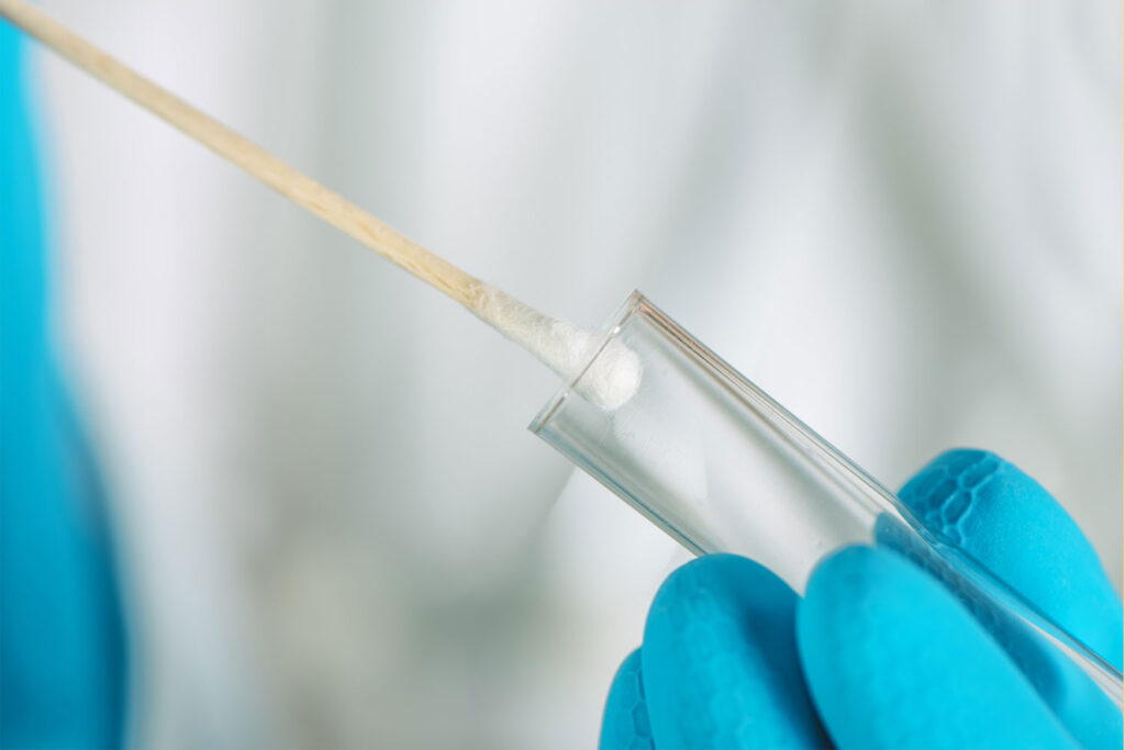 Test genetici alimentazione