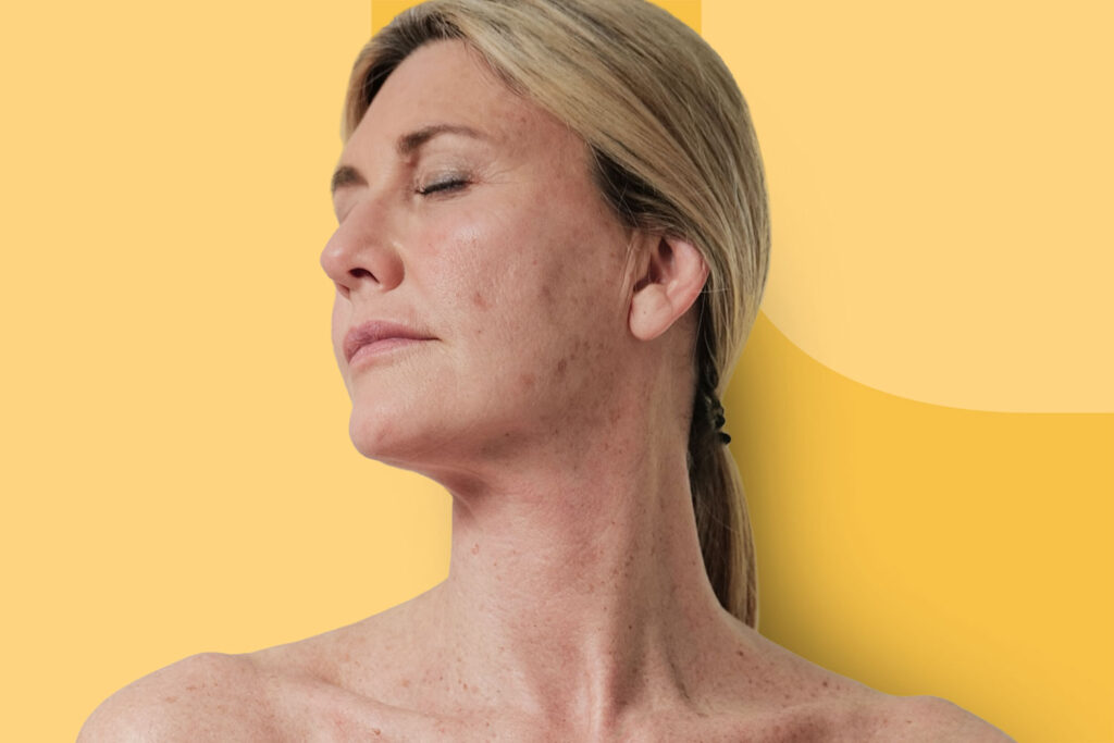 Cos’è il Pro-aging