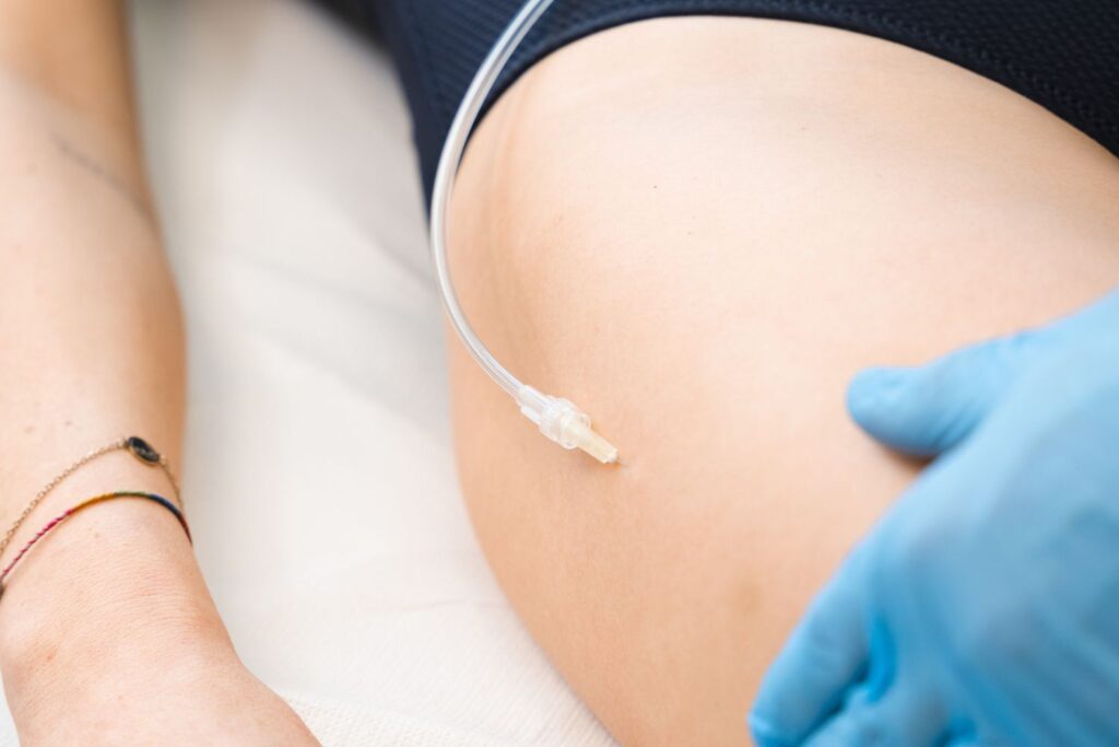 Trattamenti medico estetici per prepararsi alla prova costume
