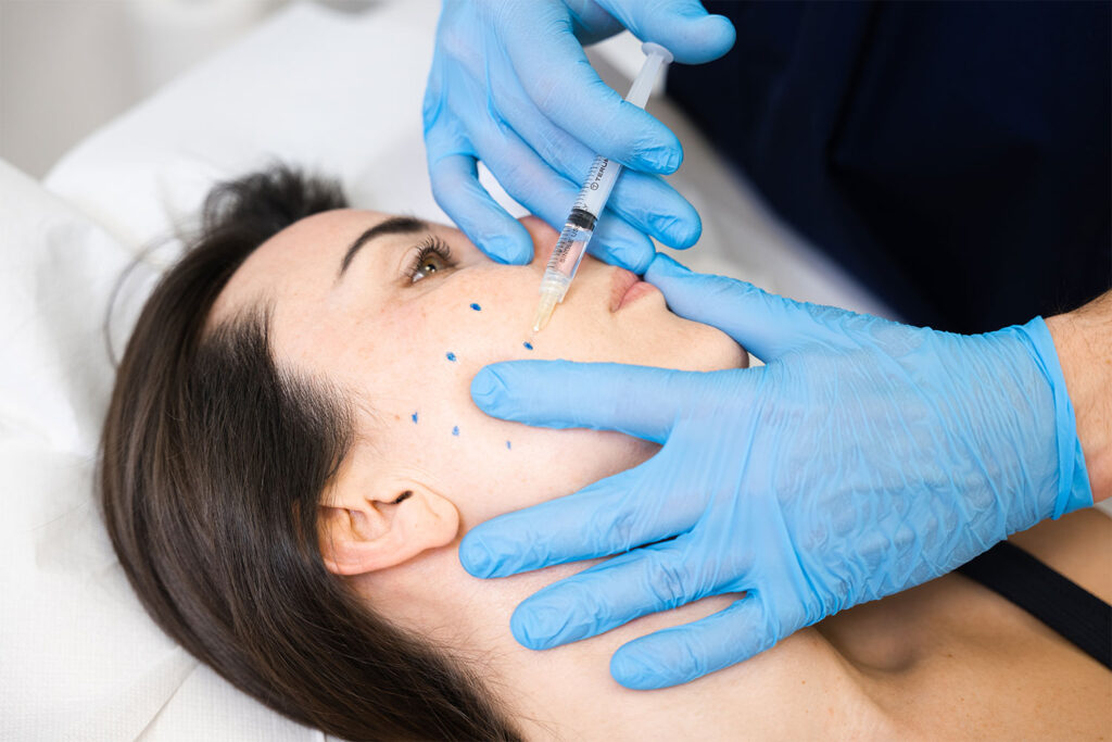 botox brescia